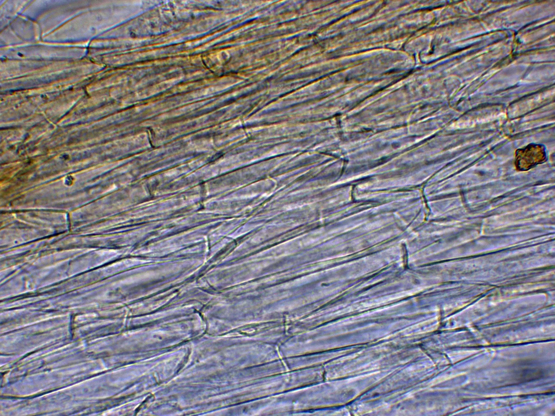 Microscopía de Inocybe grammata - 10 - Subpellis -002